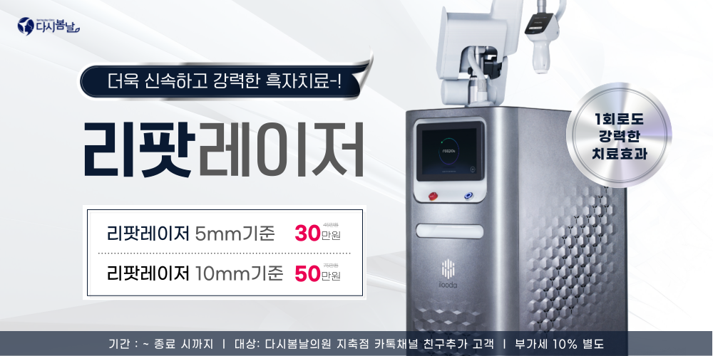 리팟레이저 이벤트